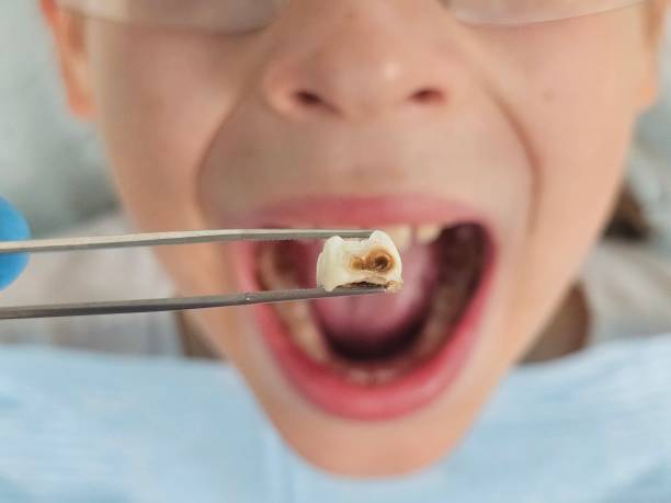 Best Weekend Emergency Dentist in Carlinvle, IL