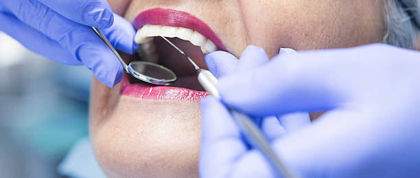 Best Mobile Emergency Dentist in Carlinvle, IL